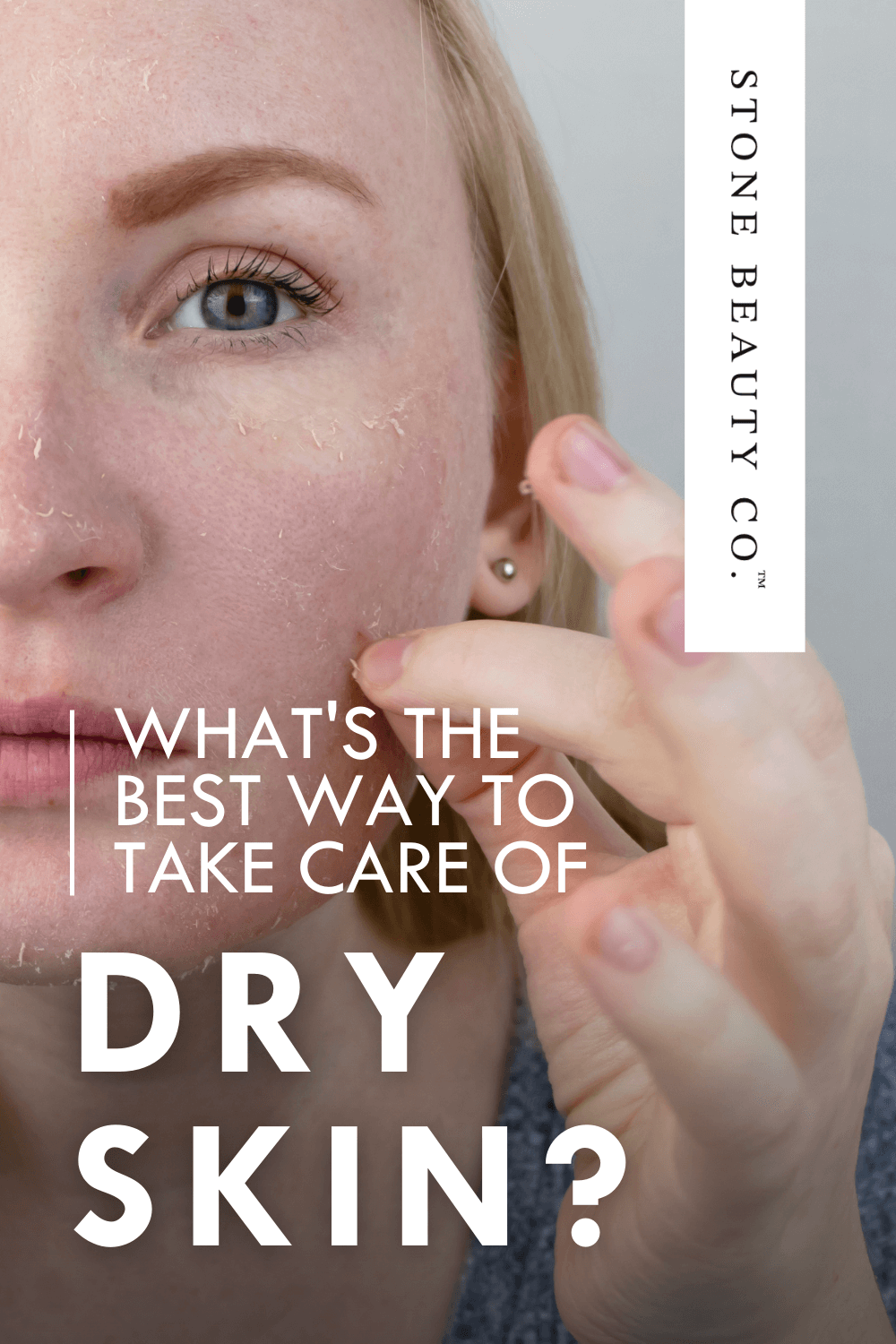 The Best Skincare Regimen for Dry Skin